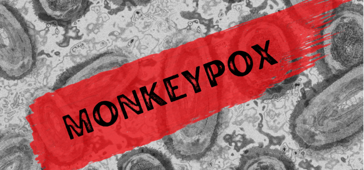 Monkeypox – Applying Lessons Learned to Improve an Equitable Global Response