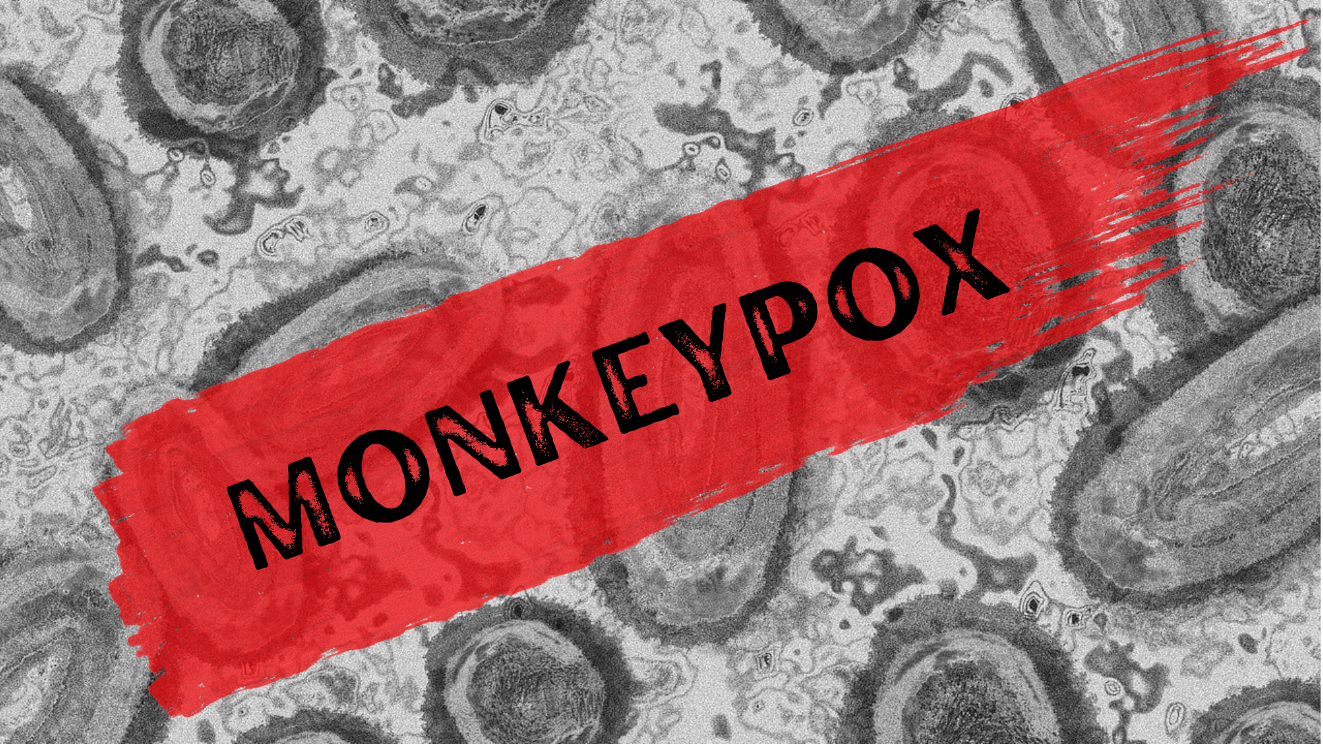 Monkeypox – Applying Lessons Learned to Improve an Equitable Global Response